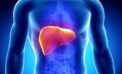 All you need to know about non-alcoholic fatty liver disease