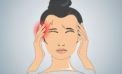 Neurologists say they are getting 5 to 6 new migraine cases everyday
