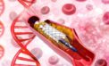 Cardiologists welcome NPPA price cap on stents, say it’s good for patients