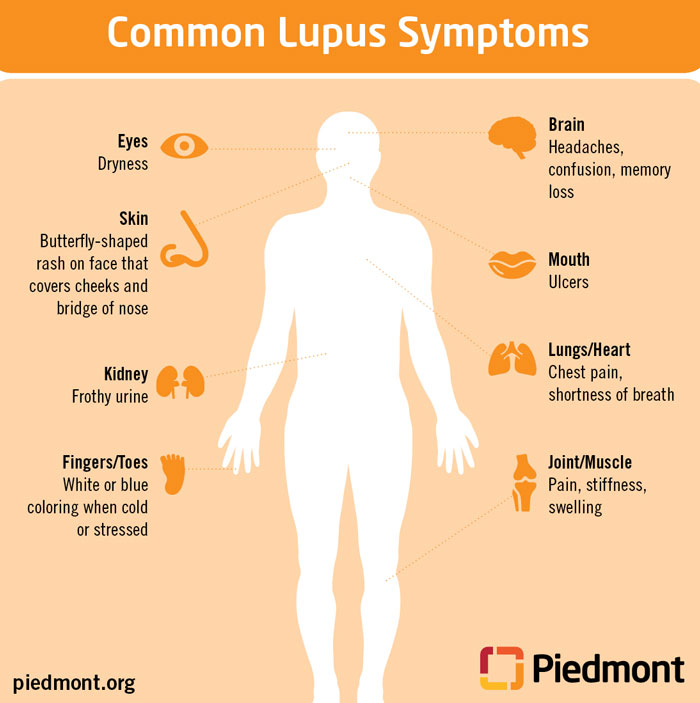 Lupus-Infographic-insert