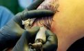 Tattoo gone wrong? Here’s how you can deal with it